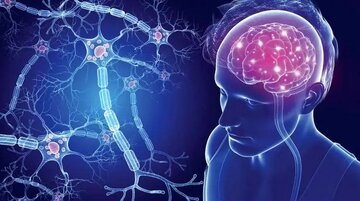 کشف جدید ام‌اس ایرانی